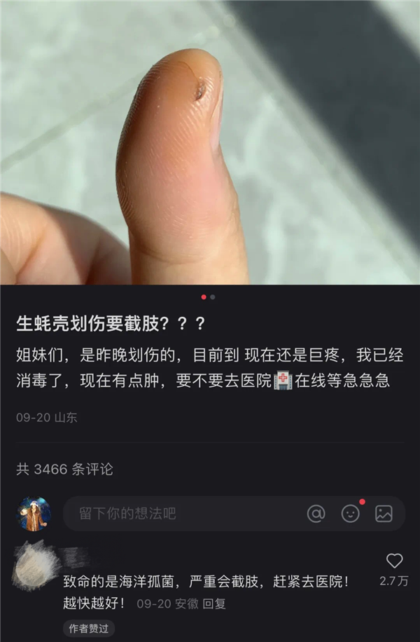 被生蚝壳划伤要截肢！我看看怎么个事