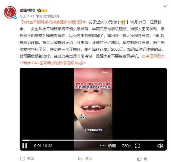 女子平躺熬夜玩手机被砸断半颗门牙：治疗花费近2000元