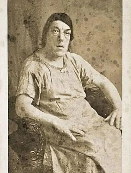 现代“人血馒头”：唐氏综合征成取笑乐子、病痛成流量密码