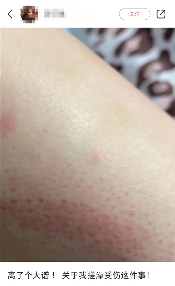 洗澡搓下来的“泥”越多 洗得越干净吗：你一直都错了