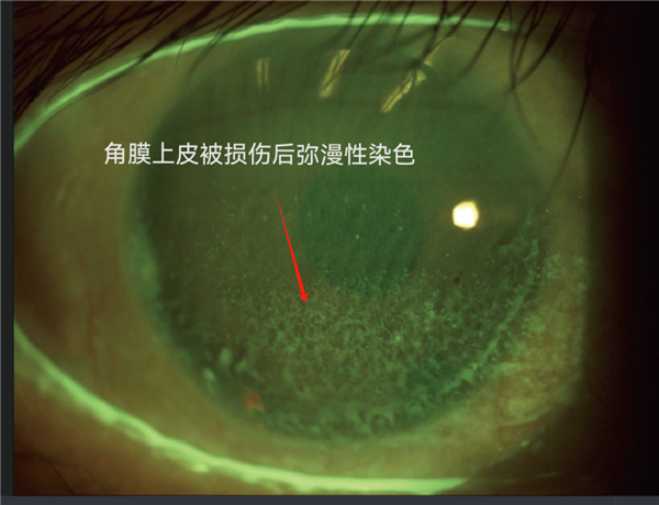 那些总戴假睫毛的人：现在都怎么样了