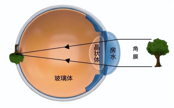 大学教授让助理戴上倒立眼镜：10天后怪异的事情发生了