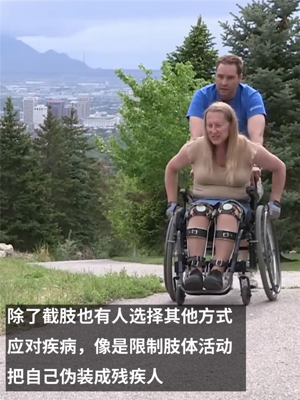 主动锯掉自己健康的大腿！只因患上了身体完整认同障碍