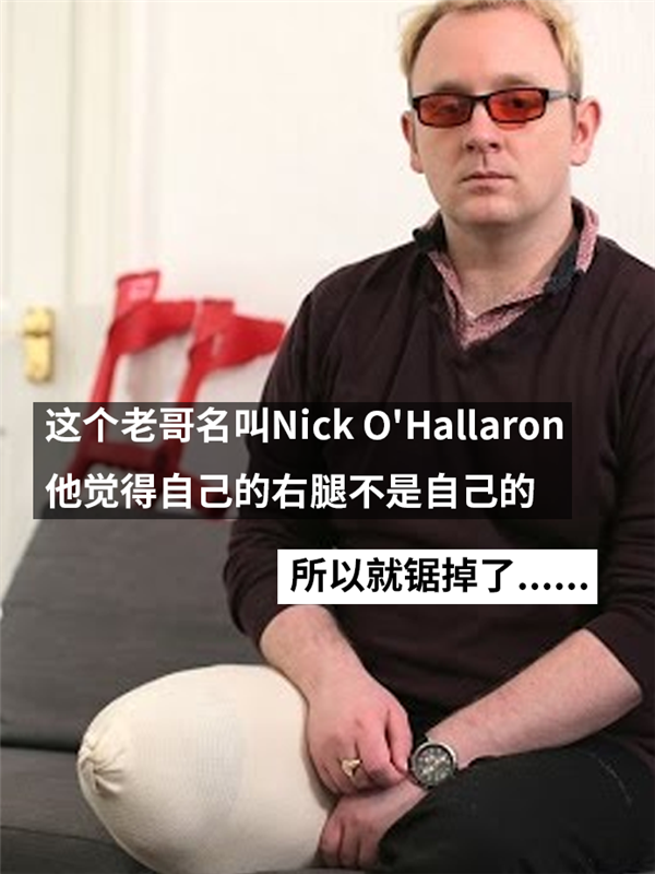 主动锯掉自己健康的大腿！只因患上了身体完整认同障碍