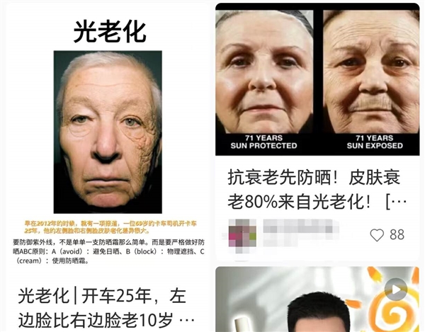 过度防晒的年轻人 开始沉迷晒背