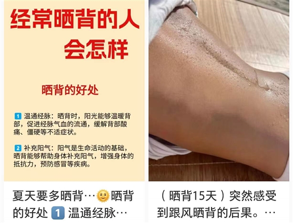 过度防晒的年轻人 开始沉迷晒背