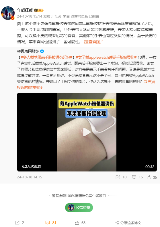 女子戴Apple Watch睡觉被烫伤起泡 苹果客服回应:过敏反应