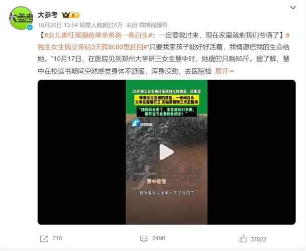 女儿患红斑狼疮单亲爸爸一夜白头:得了红斑狼疮有救吗